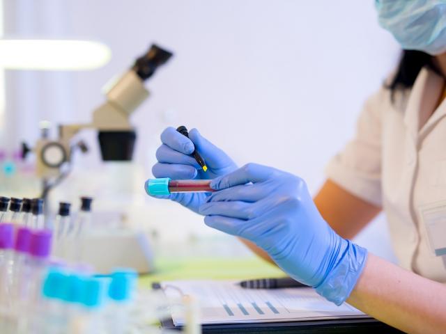 Woman examining cancer blood test on SYMPLIFY trial