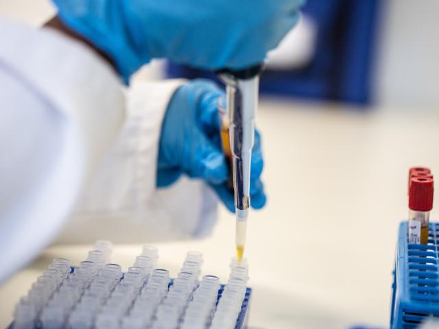A scientist testing a sample. 